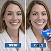 Ултравиолетова Система За Избелване На Зъби WhiteLight В Домашни Условия | Уреди за красота