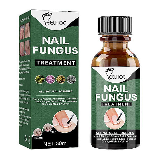EELHOE Nail Fungus - Революционен Лак за Здрави Нокти | Здраве